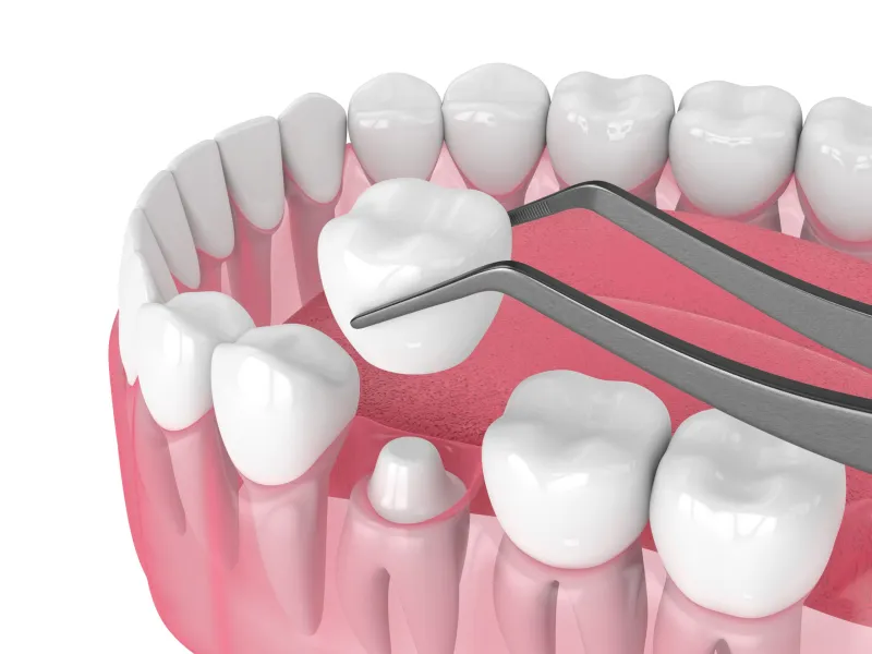Estetică dentară